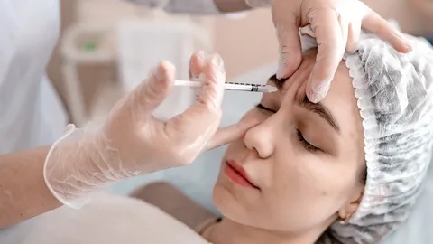 Ботулинотерапия
